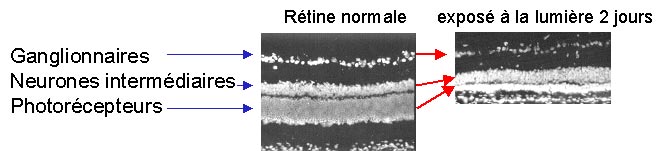 apoptose rétinienne sous la lumière