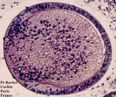 Description : Cristallin (grossissement de la coupe histologique à 41 jours)