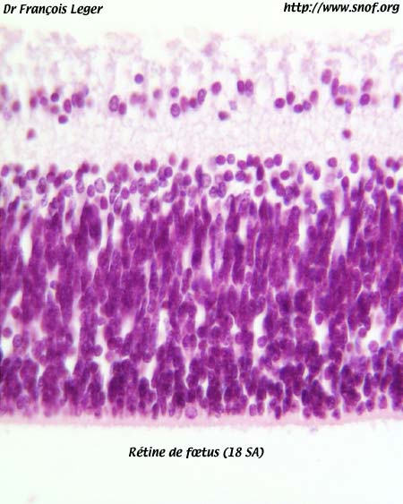 Description : Rétine de foetus de 18SA